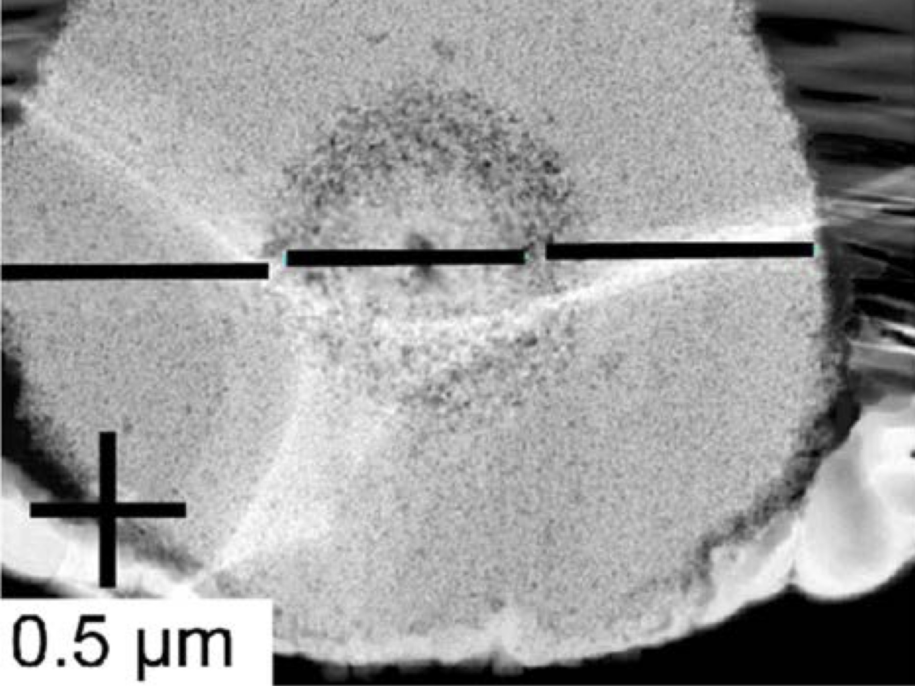 アスベスト曝露による癌発症機序の謎：喫煙者と非喫煙者のアスベスト繊維を包む含鉄タンパク質の地球化学的特徴から明らかになったこと